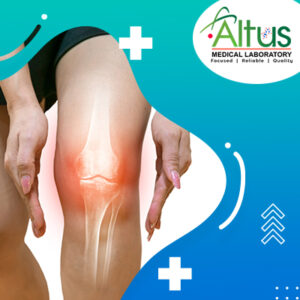 ALTUS BONE HEALTH