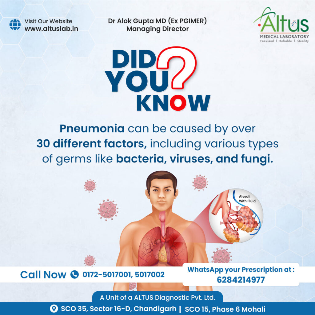 Diverse causes of pneumonia