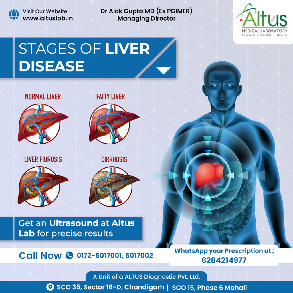 Understanding the Different Stages of Liver Disease | Altus Lab