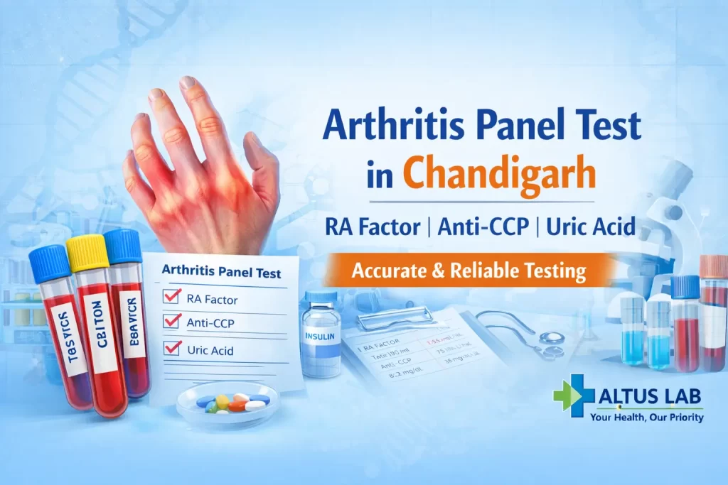 Arthritis Panel Test In Chandigarh Including RA Factor Anti-CCP And Uric Acid Blood Test At Altus Lab
