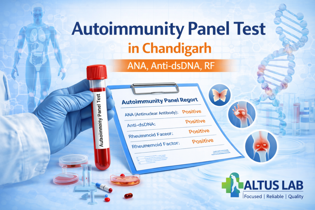 Autoimmunity Panel Test In Chandigarh At Altus Lab Including ANA Anti-dsDNA And Rheumatoid Factor Tests