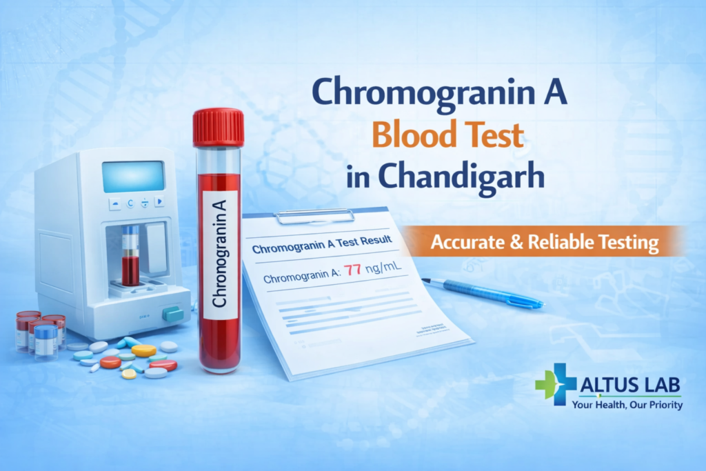 Chromogranin A Blood Test In Chandigarh At Altus Lab For Neuroendocrine Tumor Marker Testing