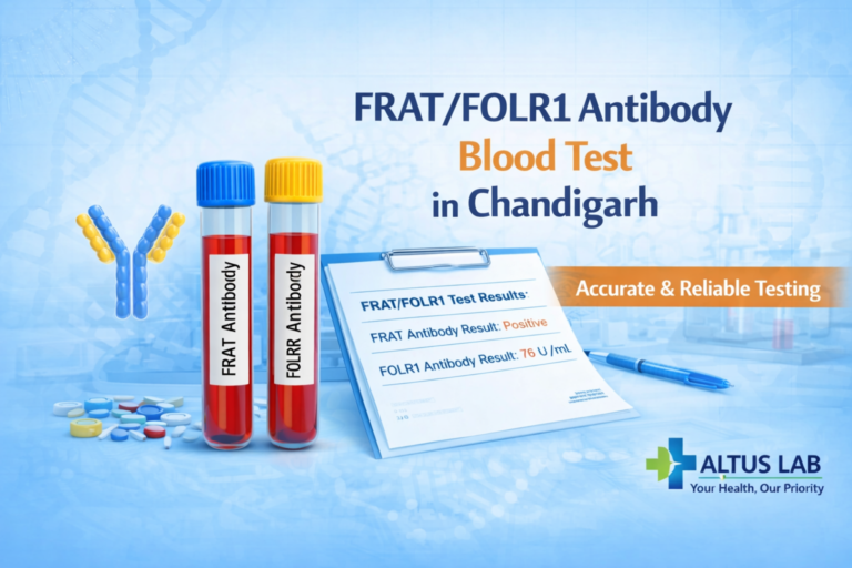 FRAT / FOLR1 Antibody Test Chandigarh | Folate Receptor Autoimmunity | Altus Lab - Altus Lab Chandigarh
