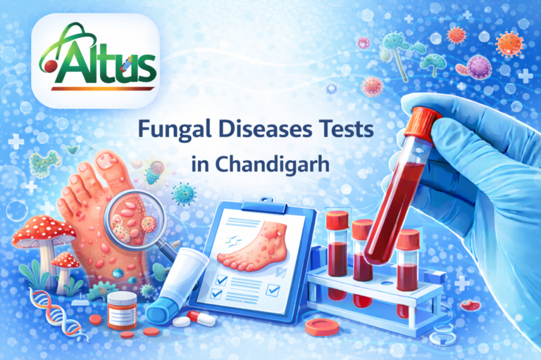 Fungal Diseases Blood Test In Chandigarh At Altus Lab For Detecting Fungal Infections