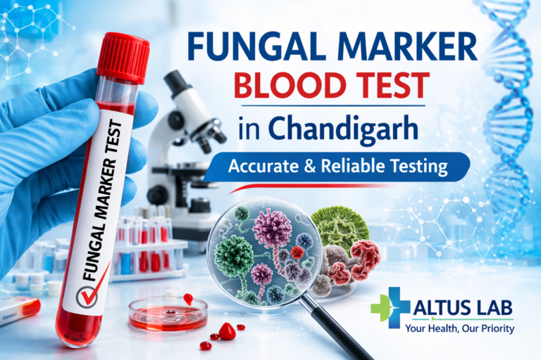 Fungal Marker Test in Chandigarh | GMI & Beta-D-Glucan | Altus Lab - Altus Lab Chandigarh