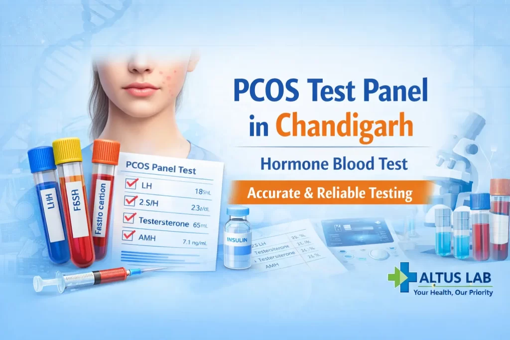 PCOS Test Panel In Chandigarh Hormone Blood Test Including LH FSH Testosterone And AMH At Altus Lab