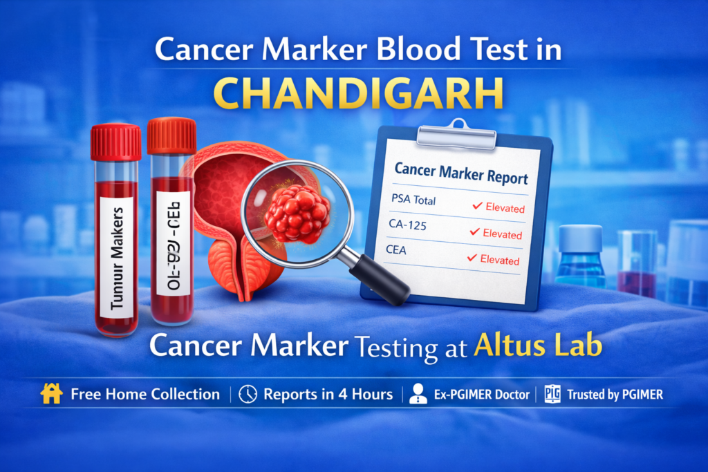 PSA Blood Test For Prostate Cancer Screening In Chandigarh At Altus Lab