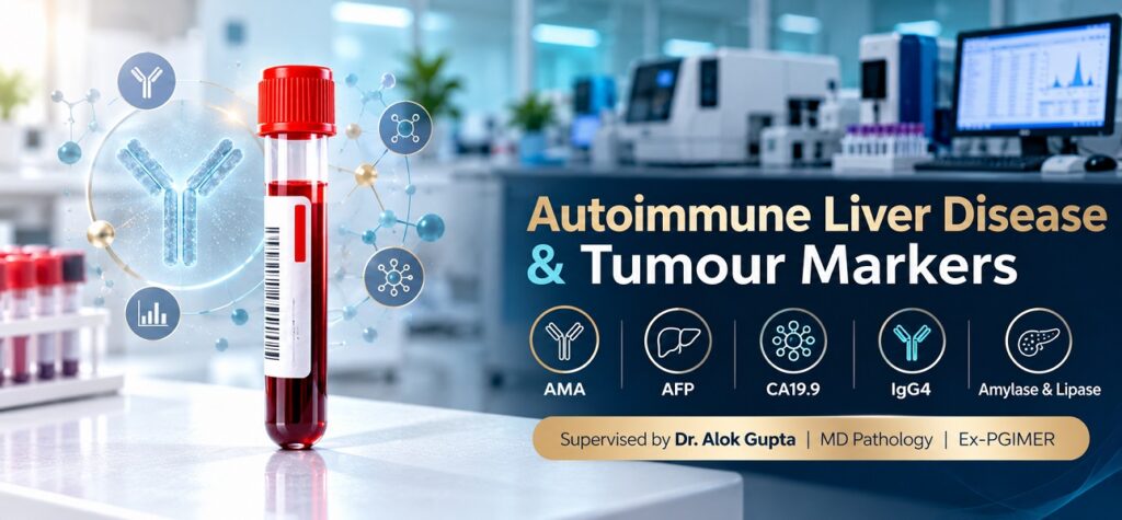 Autoimmune hepatitis and liver cancer marker tests Chandigarh — AMA AFP PIVKA-II testing at Altus Lab supervised by Dr. Alok Gupta