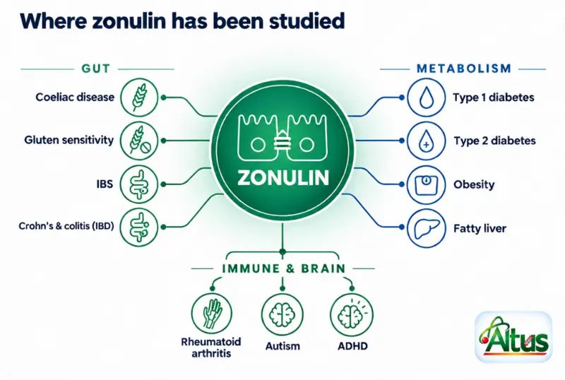Hub diagram of research areas where zonulin has been studied: gut conditions (coeliac disease, gluten sensitivity, IBS, IBD), metabolic conditions (type 1 and type 2 diabetes, obesity, fatty liver) and immune and brain conditions (rheumatoid arthritis, autism, ADHD)